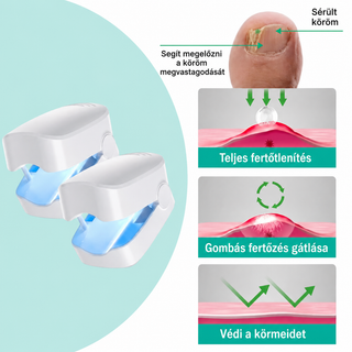NuvoCare – Kékfényes kezelés körömgomba ellen otthon